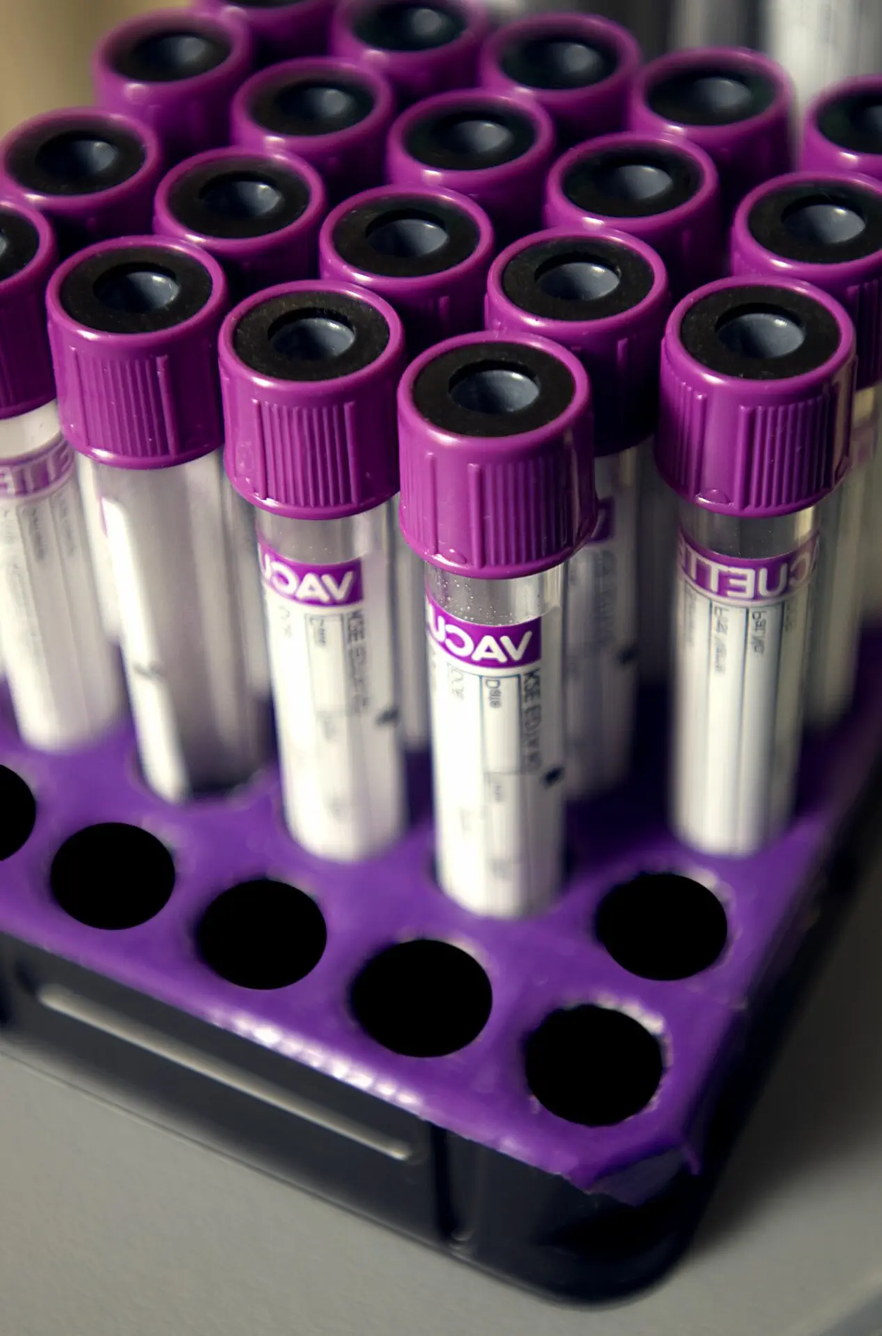lab test